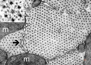 normal cardiomyocyte … transversal section (m … mitochondria, a … actin, my … myosin, arrow … tubules of s normal cardiomyocyte … transversal section (m … mitochondria, a … actin, my … myosin, arrow … tubules of s